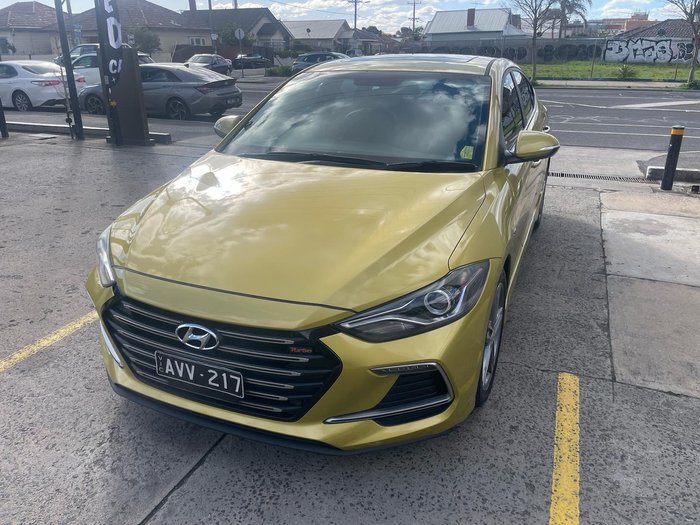 2017 Hyundai Elantra SR Turbo