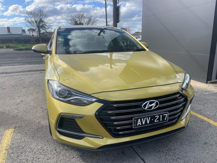 2017 Hyundai Elantra SR Turbo