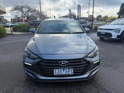 2017 Hyundai
                Elantra SR Turbo