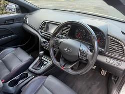 2017 Hyundai
                Elantra SR Turbo