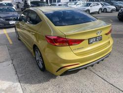 2017 Hyundai
                Elantra SR Turbo