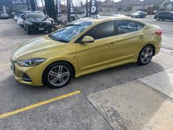 2017 Hyundai
                Elantra SR Turbo