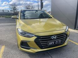 2017 Hyundai
                Elantra SR Turbo