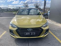 2017 Hyundai
                Elantra SR Turbo