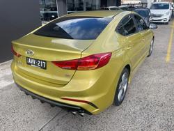 2017 Hyundai
                Elantra SR Turbo