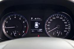 2017 Hyundai Kona Elite OS MY18 Blue Lagoon