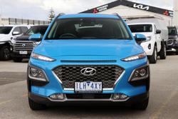 2017 Hyundai Kona Elite OS MY18 Blue Lagoon