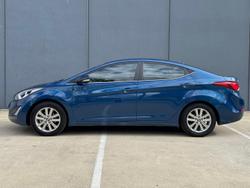 2014 Hyundai Elantra SE MD3 Dazzling Blue