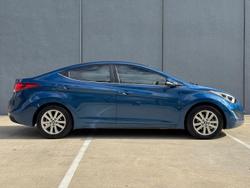 2014 Hyundai Elantra SE MD3 Dazzling Blue