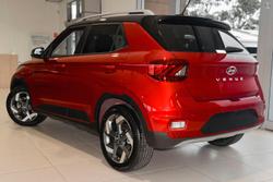 2025 Hyundai Venue Elite