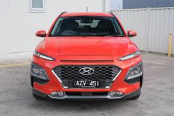 2017 Hyundai Kona Elite