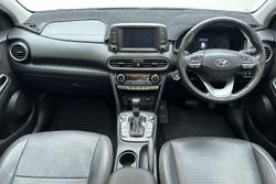 2017 Hyundai Kona Highlander