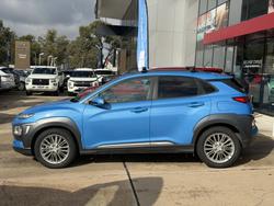 2017 Hyundai Kona Elite