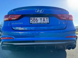 2016 Hyundai Elantra SR Turbo